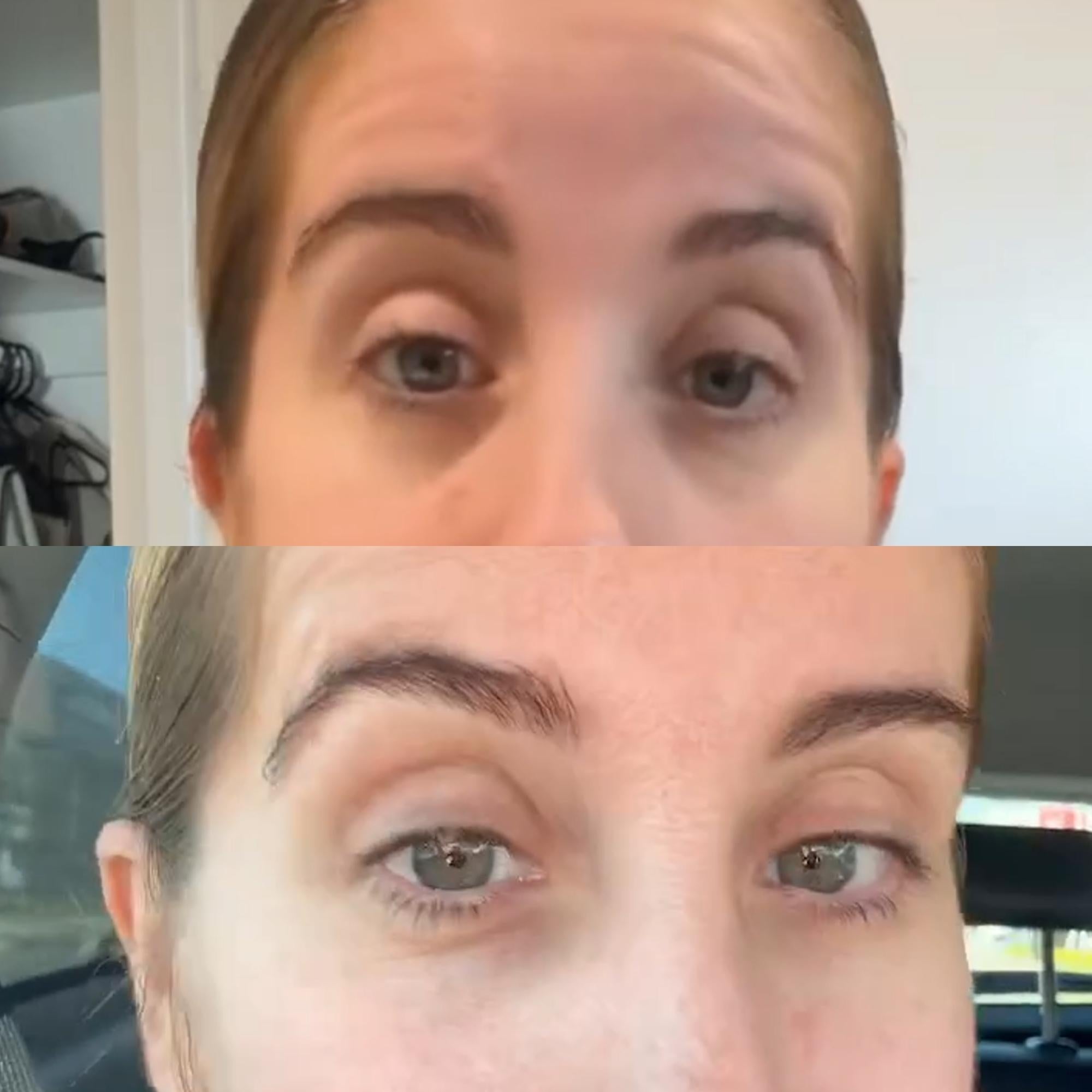 Lifting Eye Gel