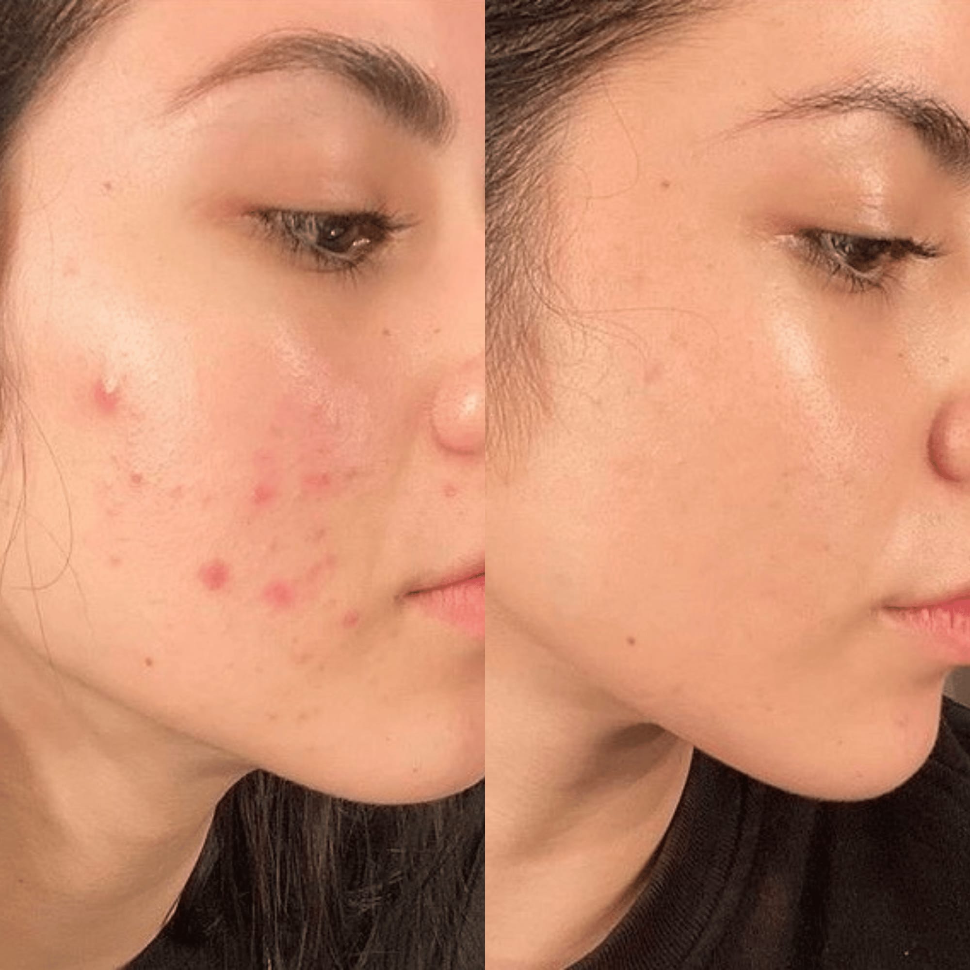 Bye Bye Breakouts System