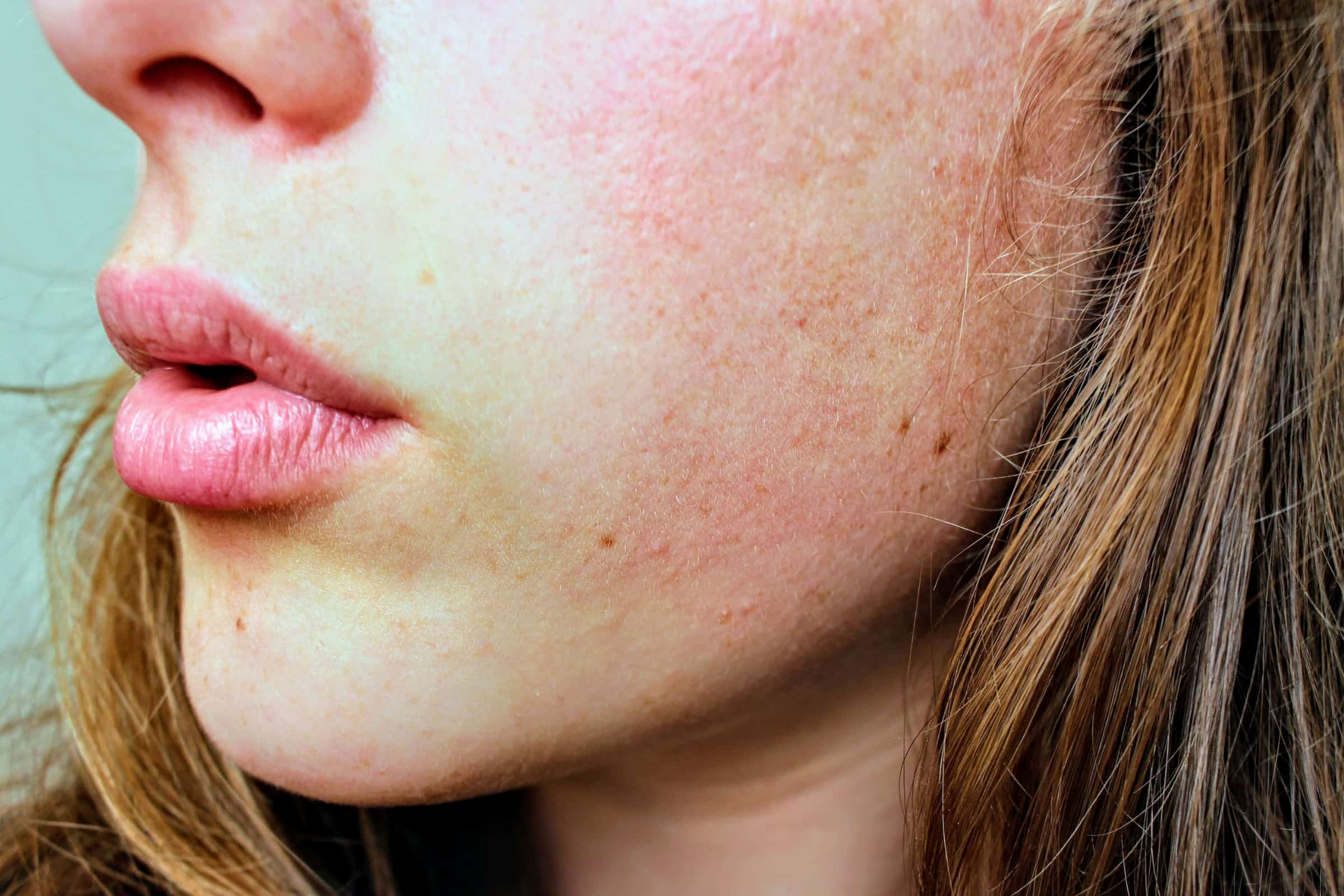 Dry vs. Dehydrated Skin: Understanding the Difference and How to Treat Both