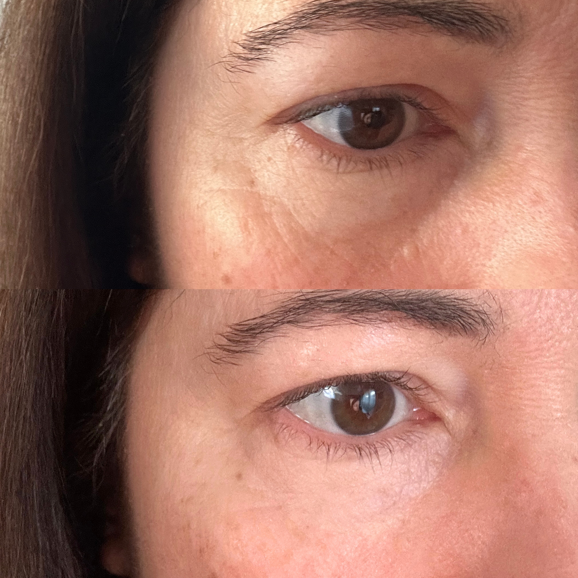 Eye Gel